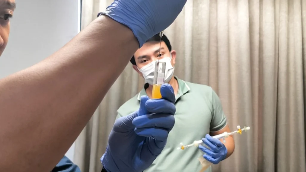 exosome